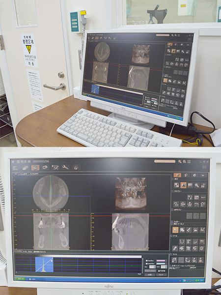 歯科用CT（3DX CT）